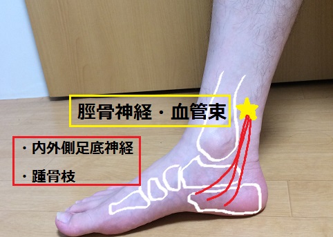 足のウラが痛い しびれる 足ウラの異常の原因 足根管症候群とは 津市おざき鍼灸接骨院