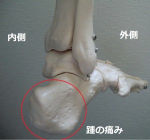 要注意 成長痛 子供の踵の痛み そのまま放置すると骨が突出変形します 津市おざき鍼灸接骨院